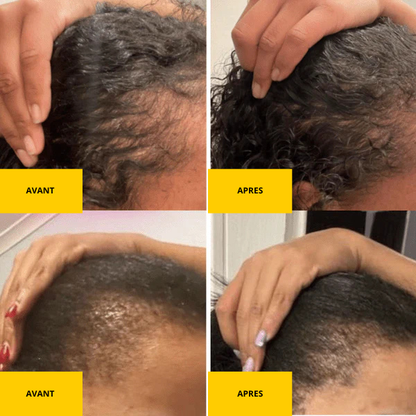 Grow Your Hair 4x Faster