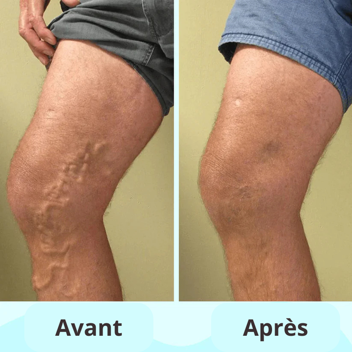 Tapis de Massage Conductif EMS