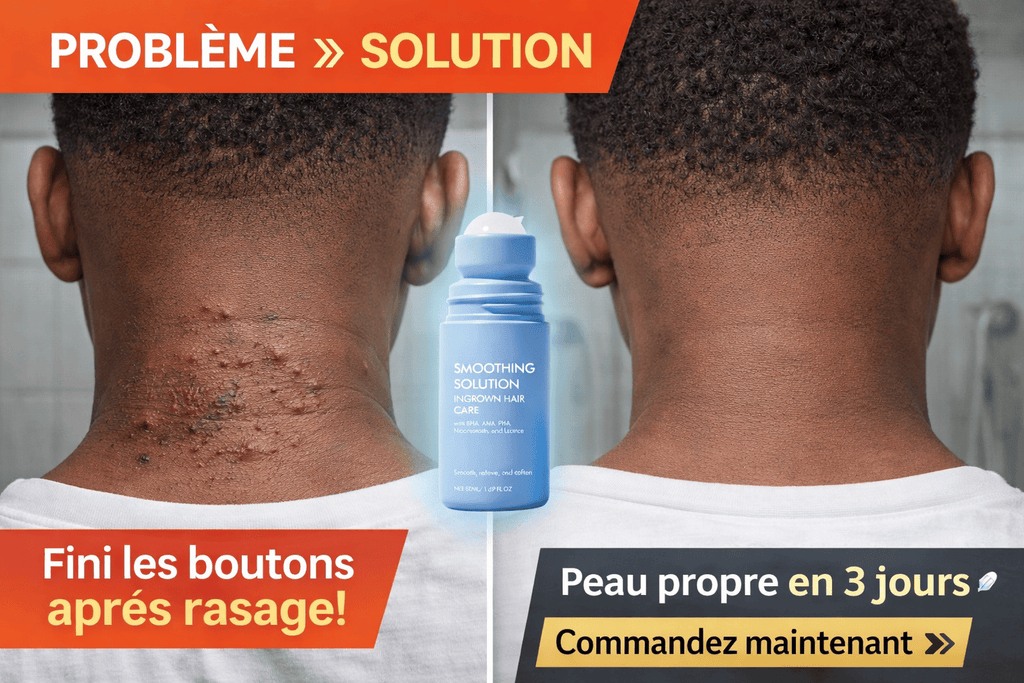 🍶Crème après-rasage anti-boutons — SoftSkin 💆‍♂️