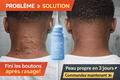 🍶Crème après-rasage anti-boutons — SoftSkin 💆‍♂️