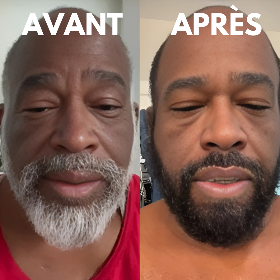 AKTALO - Say goodbye to grey hair IN 8 MINUTES! Money back guarantee