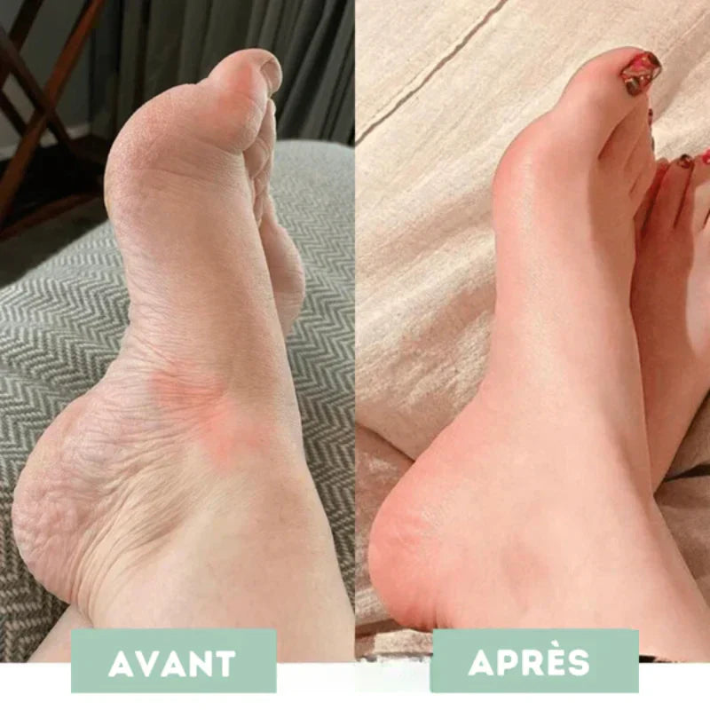 Foot massager