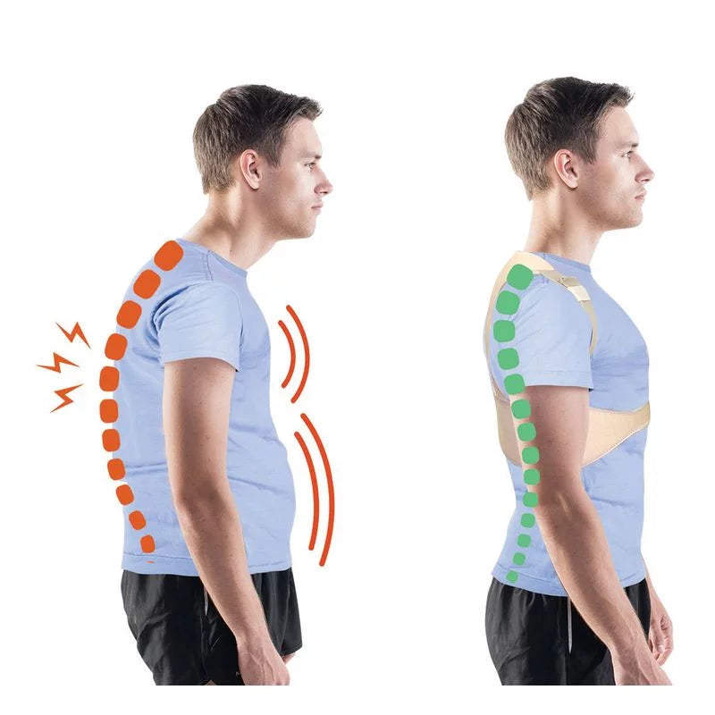 Posture corrector