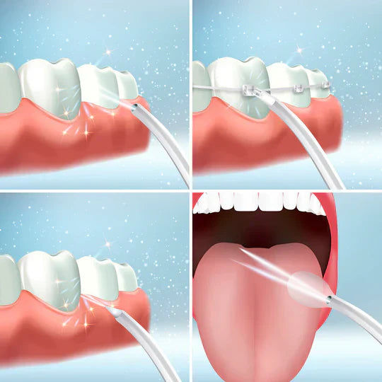 Oral Irrigator