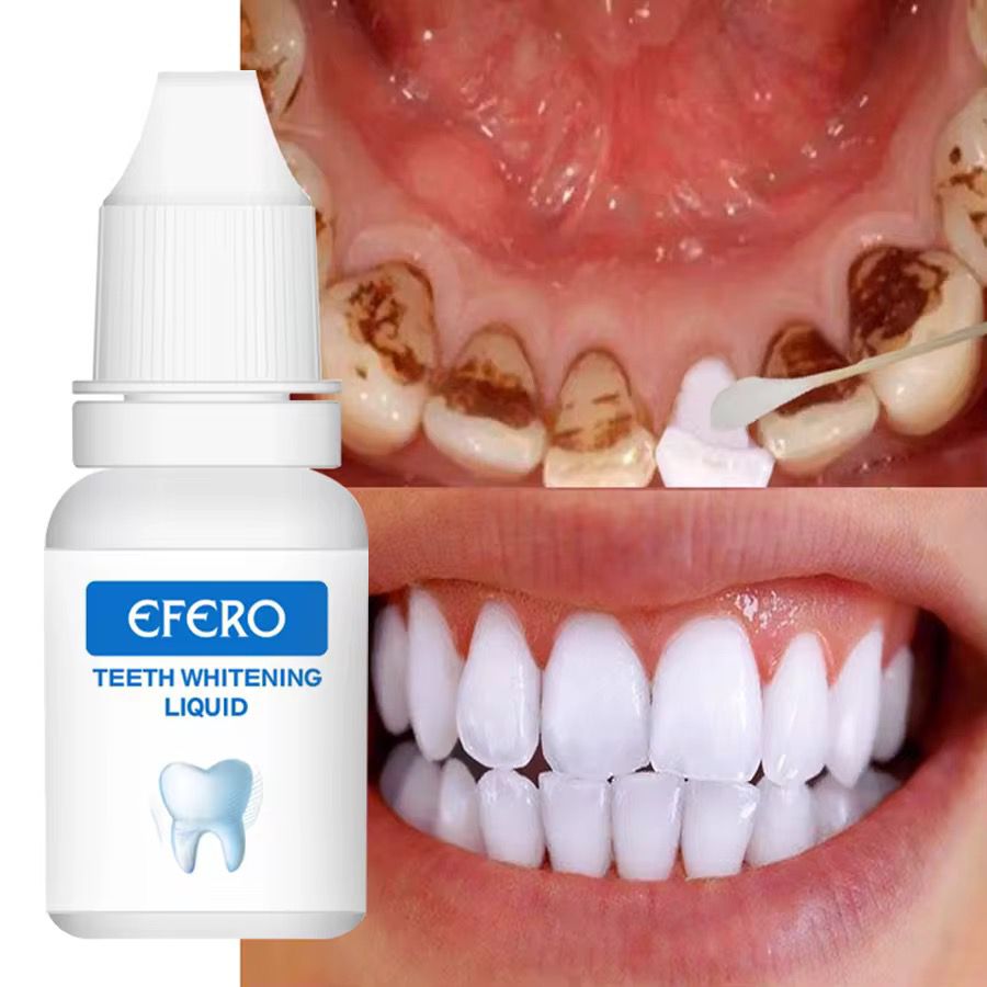 Whiten Your Teeth in 5 Days (money back guarantee)